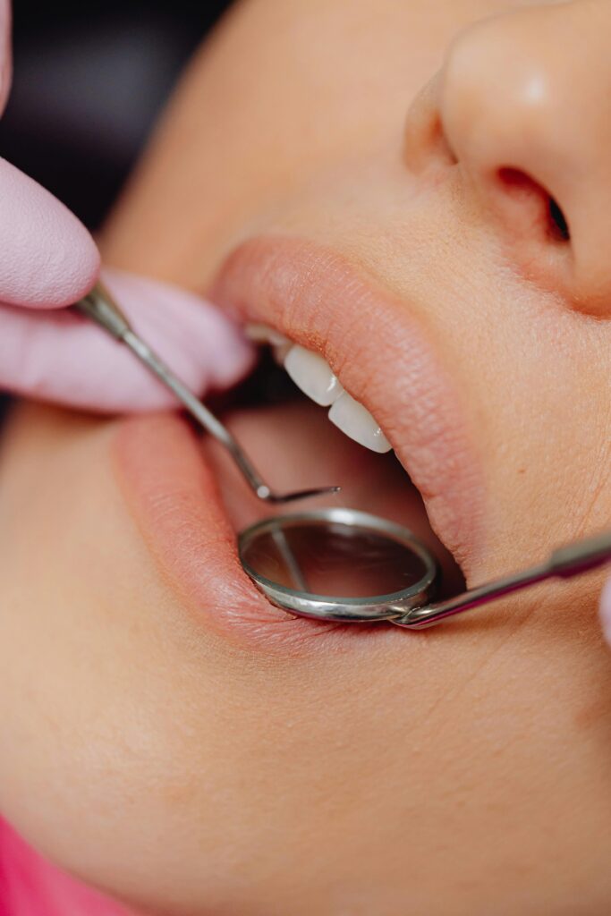 Image of dentist checking teeth